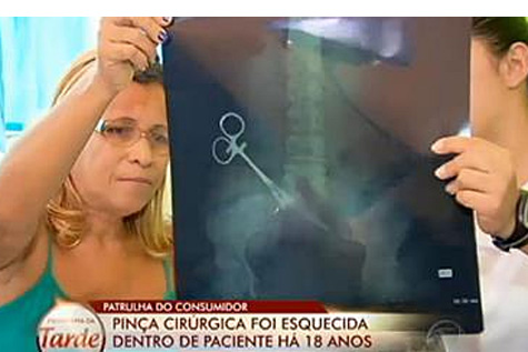 Iguaí: Mulher tem pinça cirúrgica dentro do corpo há 18 anos 