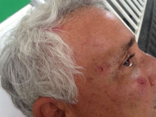 Idoso é agredido  por lutador de MMA após briga em Feira de Santana