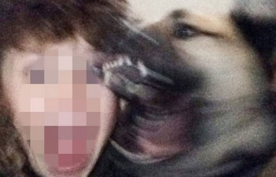 Menino leva 21 pontos ao ser mordido por cachorro enquanto fazia selfie