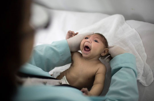 Governo Federal libera R$ 125 milhões para tratar crianças com microcefalia