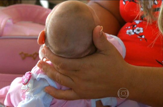 Projeto de lei prevê aumento de pena para aborto em caso de microcefalia