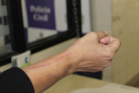 Brumado: Com estilete, bandido arranha braço de mulher durante assalto