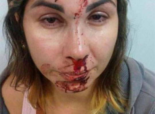 Rio de Janeiro: Mulher apanha de marido e filho denuncia agressão pelo facebook