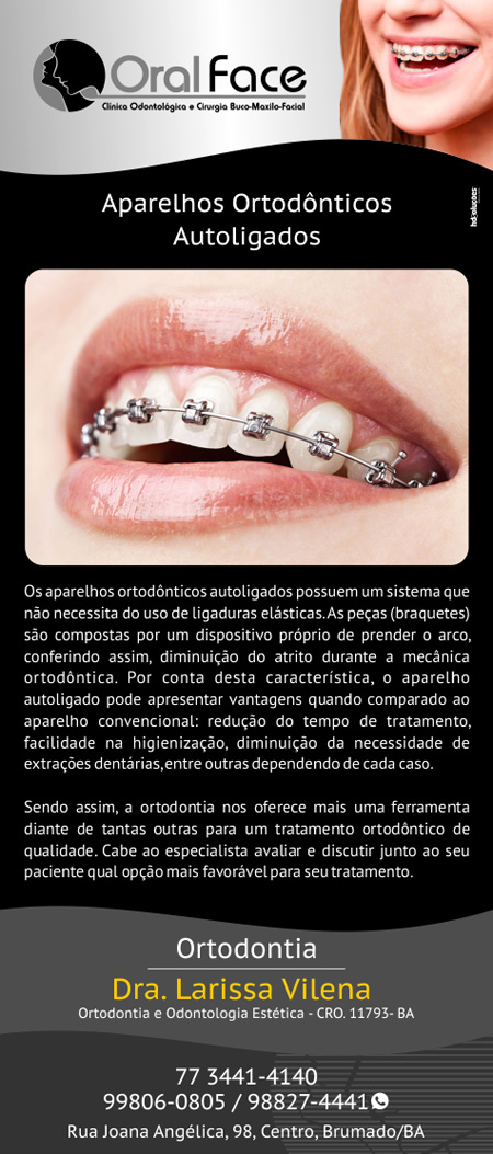 Oral Face: Aparelhos ortodônticos autoligados