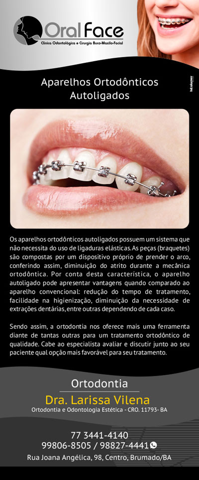 Oral Face: Aparelhos ortodônticos autoligados