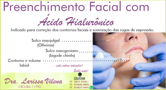 Preenchimento facial com ácido hialurônico na Oral Face em Brumado