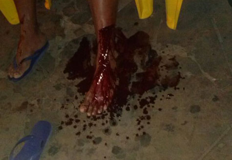 Brumado: PM à paisana fere homem com faca em lanchonete