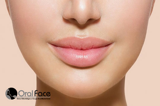 Oral Face: Preenchimento Labial