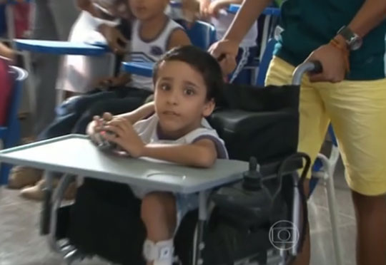 Riacho de Santana: Menino que foi separado do irmão siamês já frequenta a escola