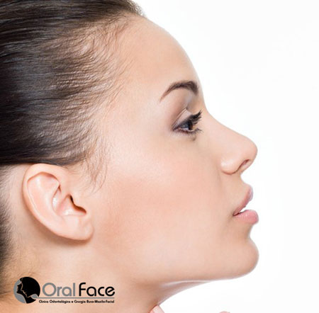 Oral Face: Rinomodelação ou Bioplastia Nasal