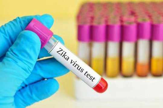 Planos de saúde terão que cobrir teste de zika vírus