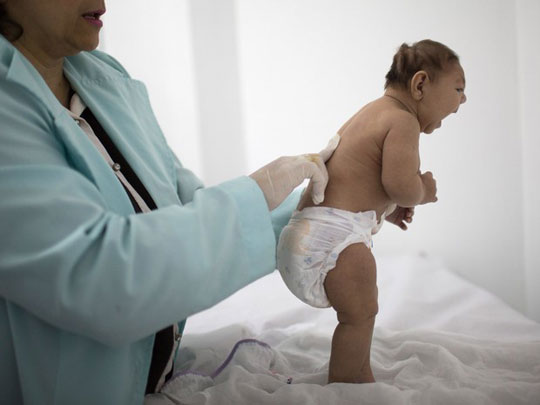 Novo estudo reforça relação entre zika e microcefalia